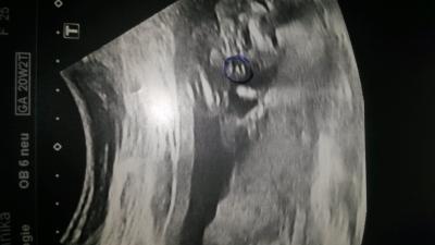 Bild zu Outing :) - Forum für Februar - Mamis