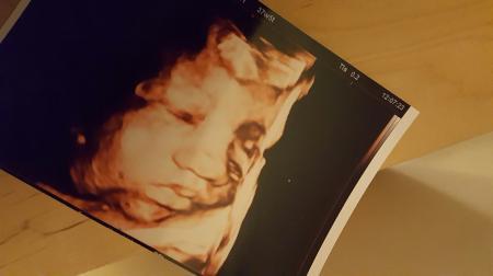 Bild zu Letzter FA Termin mit US - Forum für Februar - Mamis
