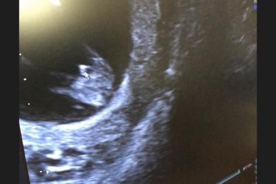 Bild zu Geschlecht Ultraschall - Forum für Februar - Mamis