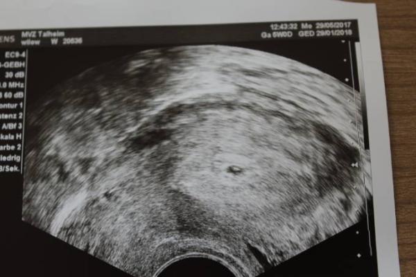 Bild zu Darf ich vorstellen? Meine kleine Bohne - Forum für Februar - Mamis