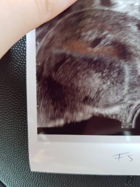 Bild zu Erster FA Termin - Forum für Februar - Mamis