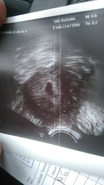 Bild zu Heute beim fa. Ich kann es nicht fassen - Forum für Februar - Mamis
