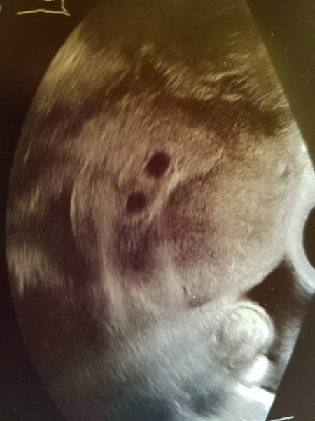 Bild zu 2 Babys und 2 Eierstöcke auf Abwegen - Forum für Februar - Mamis