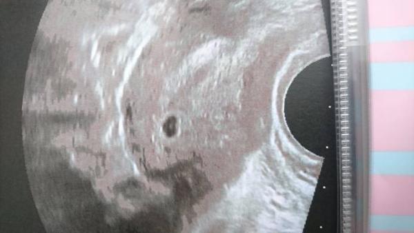 Bild zu 1. Fa Termin - Forum für Februar - Mamis
