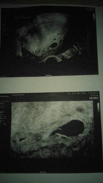 Bild zu Heute in der uniklinik - Forum für Februar - Mamis