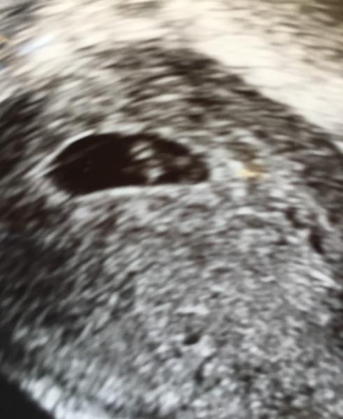 Bild zu Ein Herzchen - Forum für Februar - Mamis