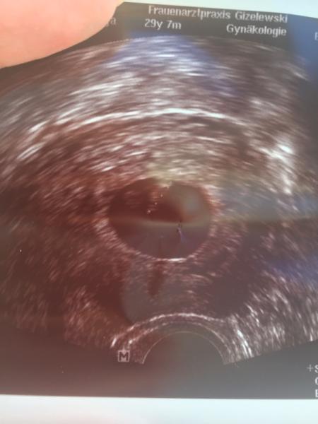 Bild zu Auch ich war beim Arzt. - Forum für Februar - Mamis