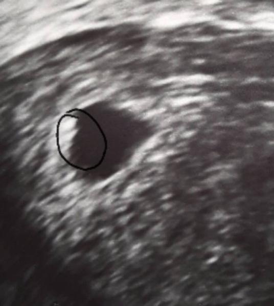 Bild zu Könnt ihr es auch sehen? - Forum für Februar - Mamis