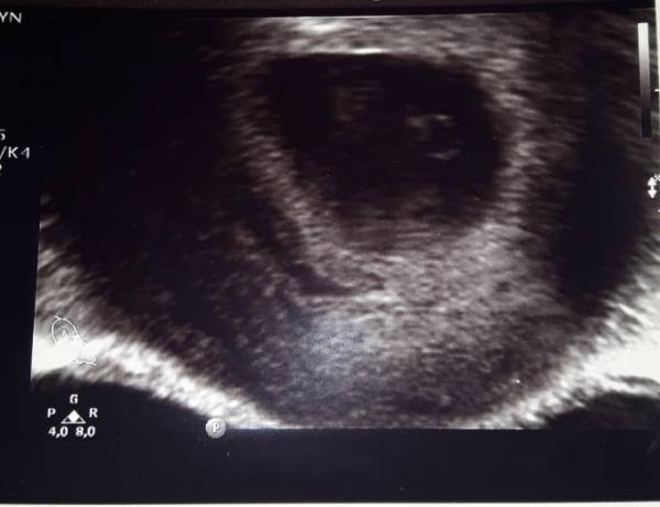 Bild zu 1. FA Termin und überglücklich - Forum für Februar - Mamis