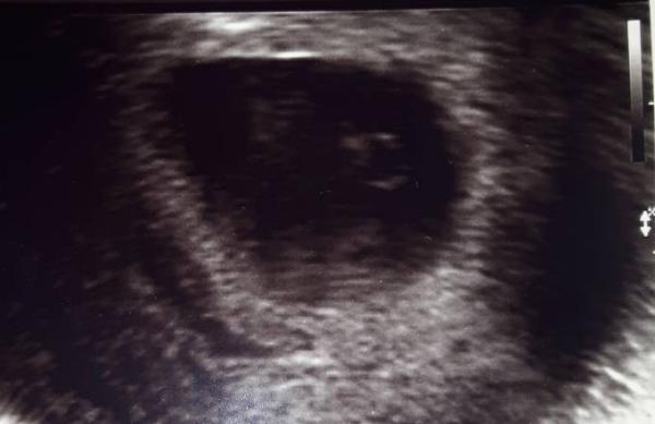 Bild zu Ultraschallbild - Forum für Februar - Mamis