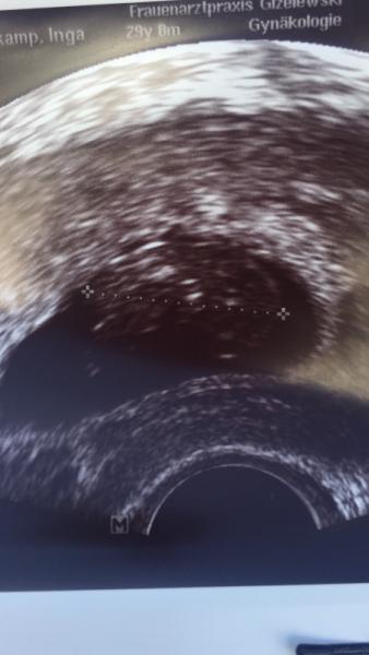 Bild zu Nachkontrolle durch FA - Forum für Februar - Mamis