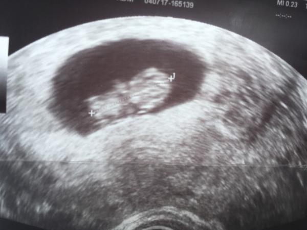 Bild zu FA Termin, Foto & vordatiert - Forum für Februar - Mamis