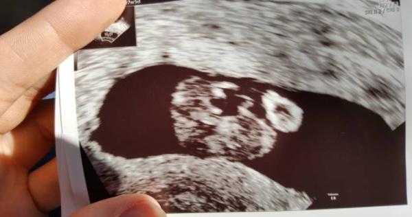 Bild zu FA termin - Forum für Februar - Mamis