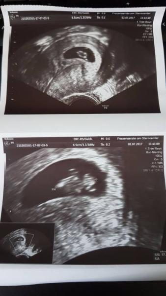 Bild zu Erste FA Termin und so glücklich  - Forum für Februar - Mamis