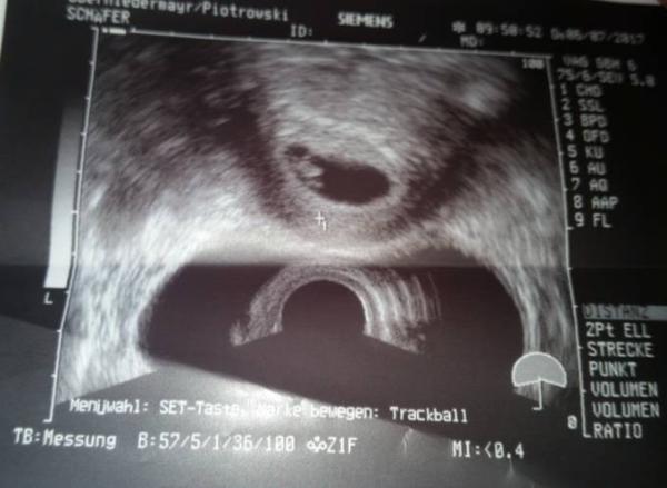 Bild zu Wir haben es gesehen! !! - Forum für Februar - Mamis