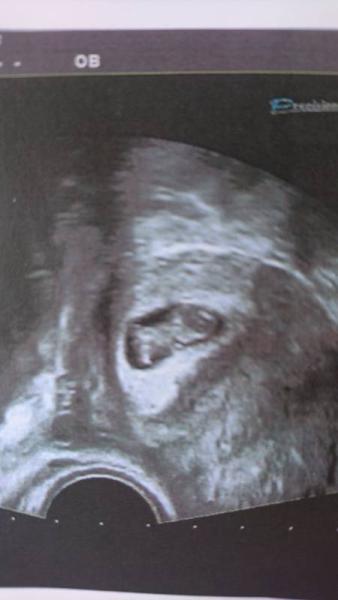 Bild zu Erdnuss oder Gummibärchen? - Forum für Februar - Mamis