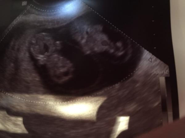 Bild zu Erleichtert - Forum für Februar - Mamis