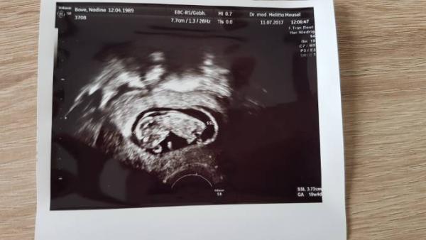 Bild zu 1. Trimester Screening - Forum für Februar - Mamis