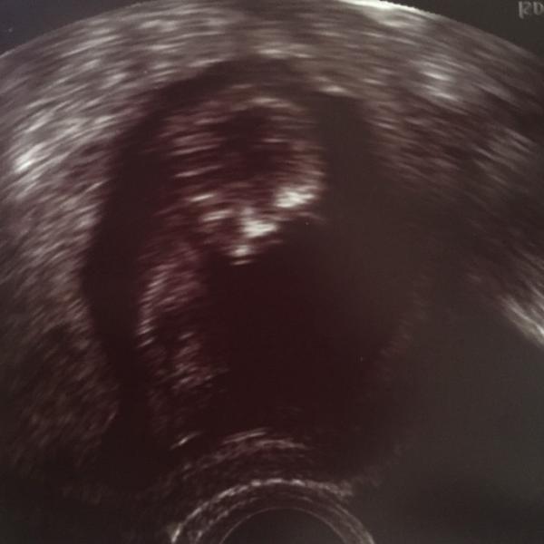 Bild zu Termin und vordatiert :) - Forum für Februar - Mamis