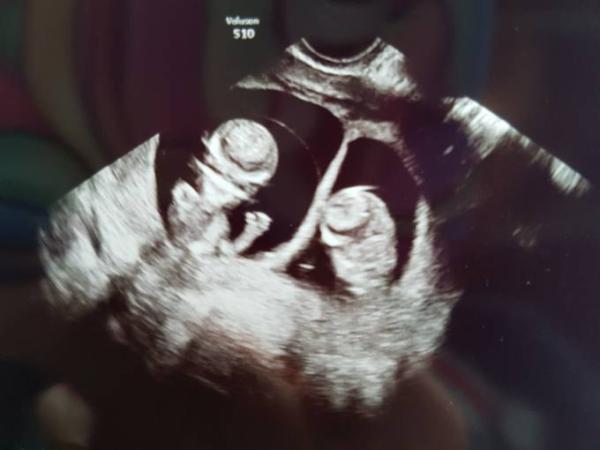 Bild zu FA - alles prima - Forum für Februar - Mamis