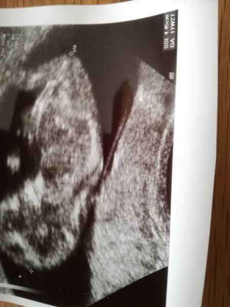 Bild zu US foto - Forum für Februar - Mamis