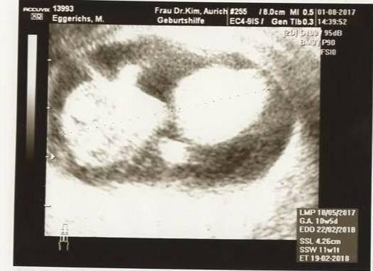 Bild zu Zurück vom fa - Forum für Februar - Mamis