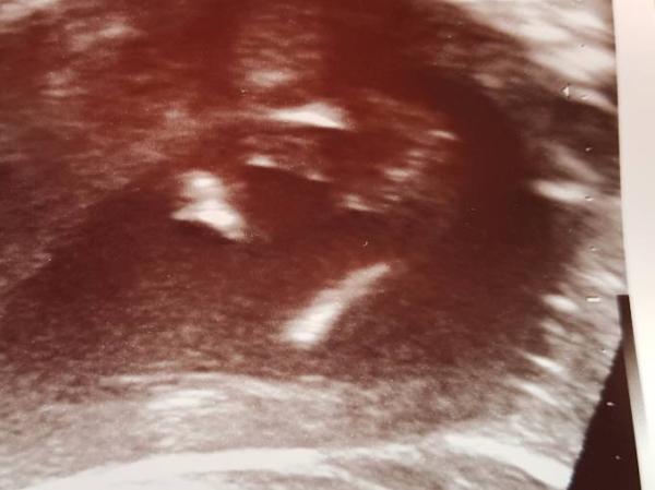 Bild zu Schweres Baby+ Outing raten:) - Forum für Februar - Mamis