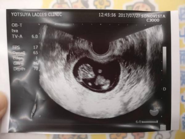 Bild zu Wünschst mir Kraft! - Forum für Februar - Mamis
