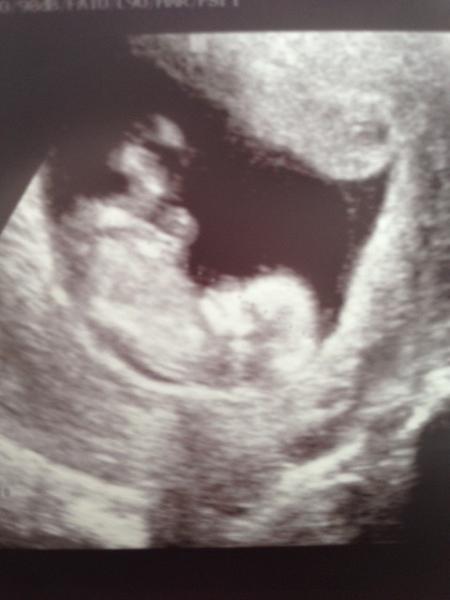 Bild zu Freude? - Forum für Februar - Mamis