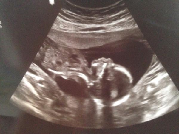 Bild zu Unser kleiner Spatz ... - Forum für Februar - Mamis