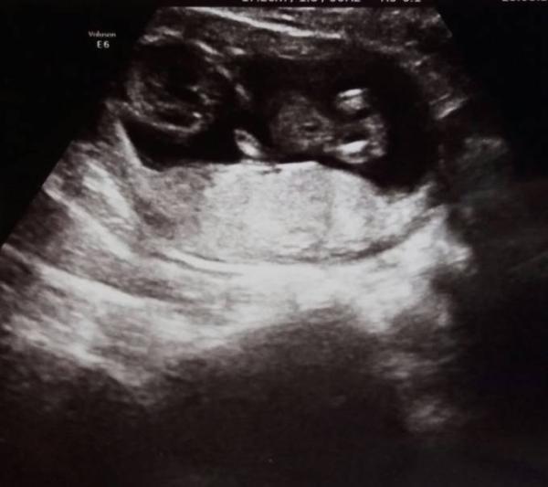 Bild zu Baby TV leider ohne Outing - Forum für Februar - Mamis