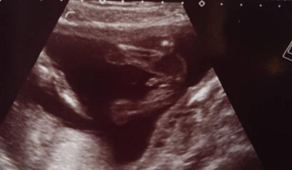 Bild zu Baby TV und Outing - Forum für Februar - Mamis