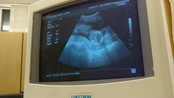 Bild zu Tendenz und Eisenmangel - Forum für Februar - Mamis