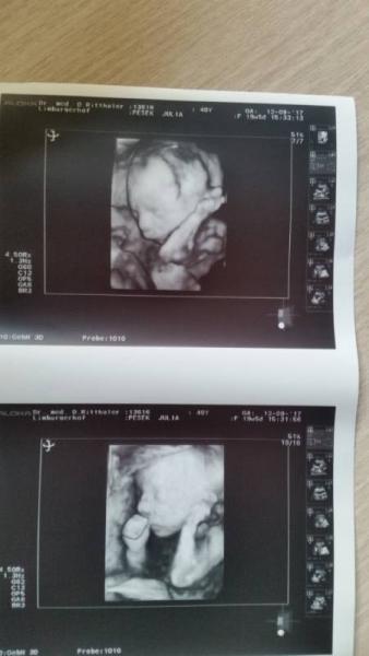 Bild zu Erstes 3D Bild - ich bin verliebt! - Forum für Februar - Mamis