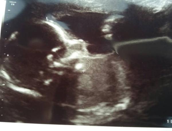Bild zu Termin mit Outing. :) - Forum für Februar - Mamis