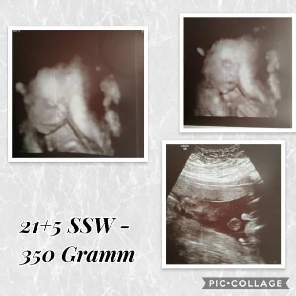 Bild zu Heute wieder 3d us - Forum für Februar - Mamis