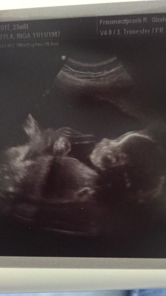 Bild zu Termin/ Eisenwert im Keller. - Forum für Februar - Mamis