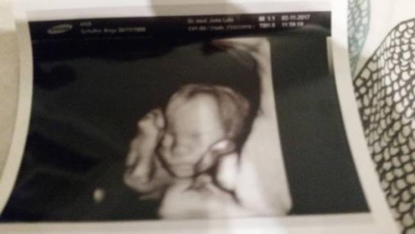 Bild zu Willkommen 7.Monat + US Bild - Forum für Februar - Mamis