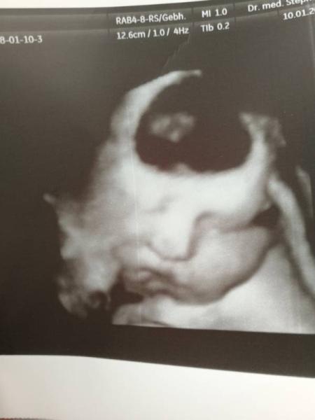 Bild zu Update - Forum für Februar - Mamis