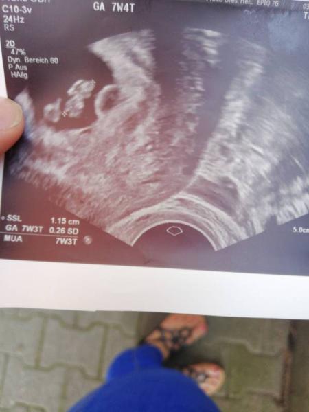 Bild zu Heute endlich fa Termin gehabt:-) - Forum für Februar - Mamis