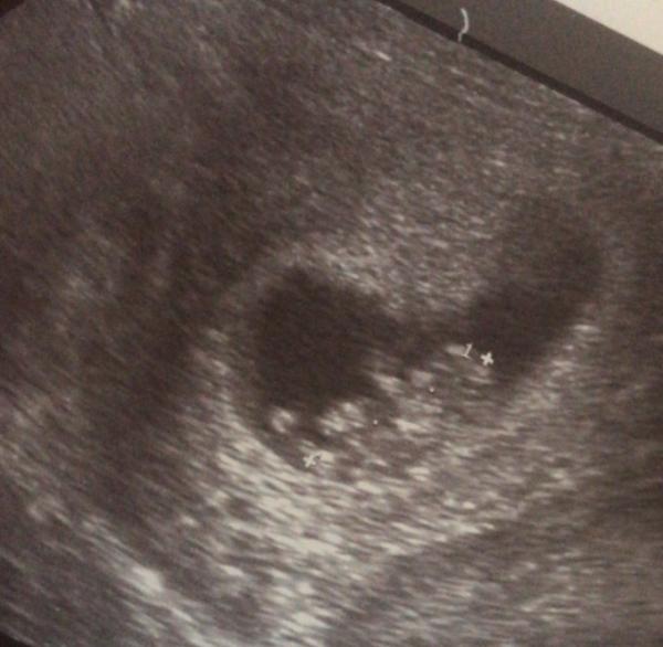 Bild zu Wieder nach Hause - Forum für Februar - Mamis
