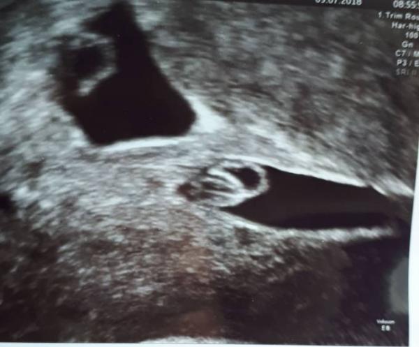 Bild zu Erster FA Besuch - Forum für Februar - Mamis