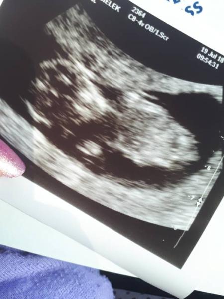 Bild zu FA Termin mit US - Forum für Februar - Mamis