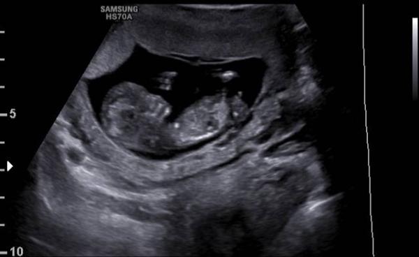 Bild zu Neues von uns :) - Forum für Februar - Mamis