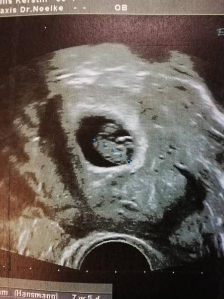 Bild zu Zurück von der Fä - Forum für Februar - Mamis