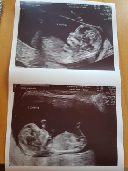 Bild zu Ersttrimesterscreening und Praenatest - Forum für Februar - Mamis