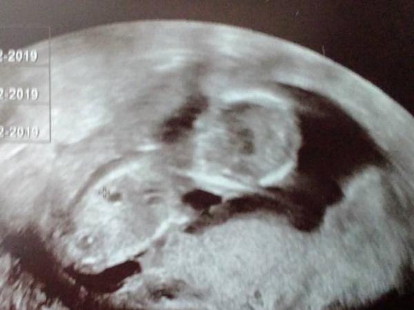 Bild zu Gestern FA Termin - Forum für Februar - Mamis