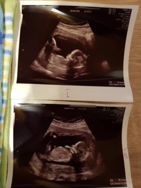 Bild zu Heute wieder Termin gehabt 😊 - Forum für Februar - Mamis