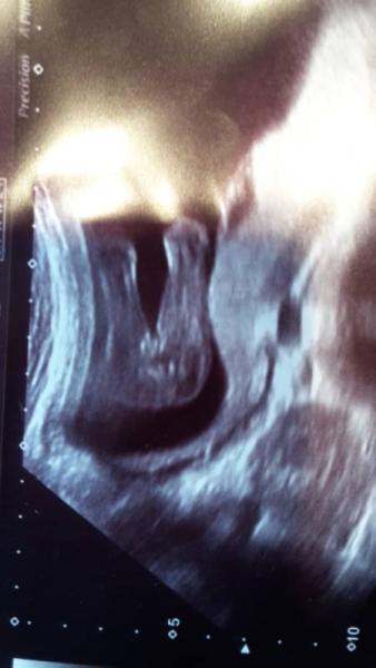Bild zu Geschlecht 18 ssw sicher? - Forum für Februar - Mamis