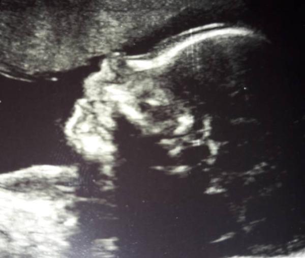 Bild zu Wieder da vom 2. Screening - Forum für Februar - Mamis